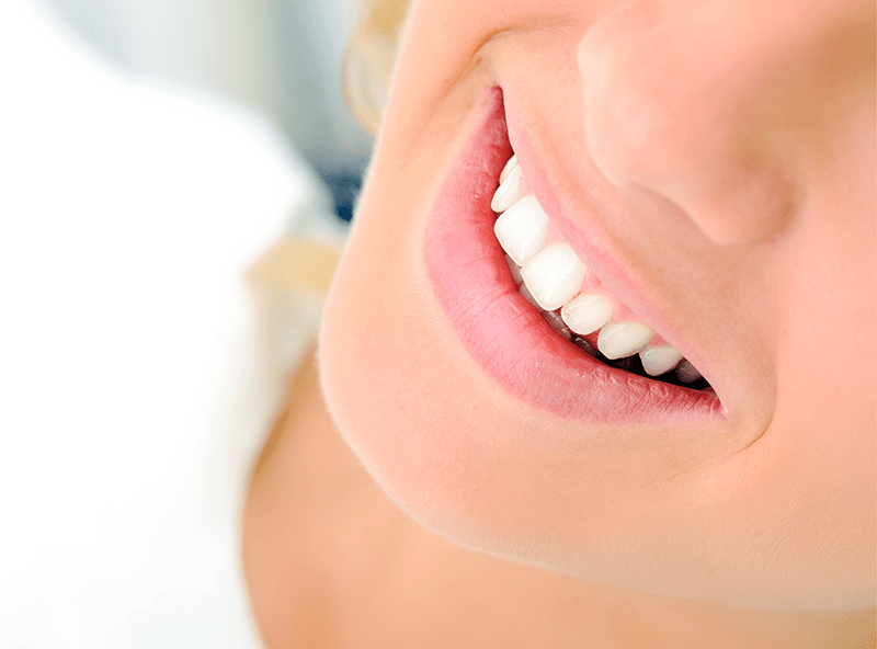 Como Clarear os dentes: Sete Dicas infalíveis